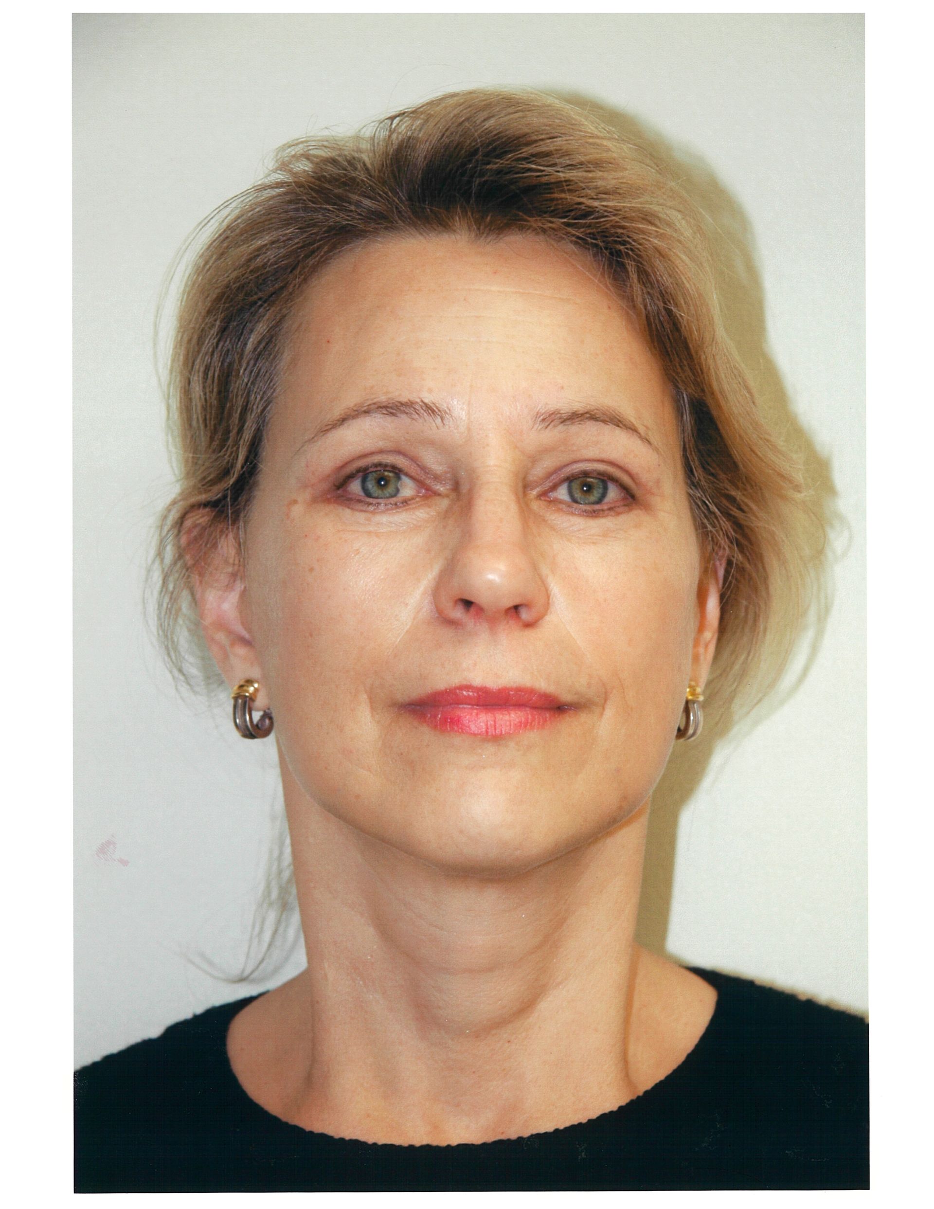 Woman with blonde hair, wearing a black shirt, looking forward. Soft smile, fair skin.