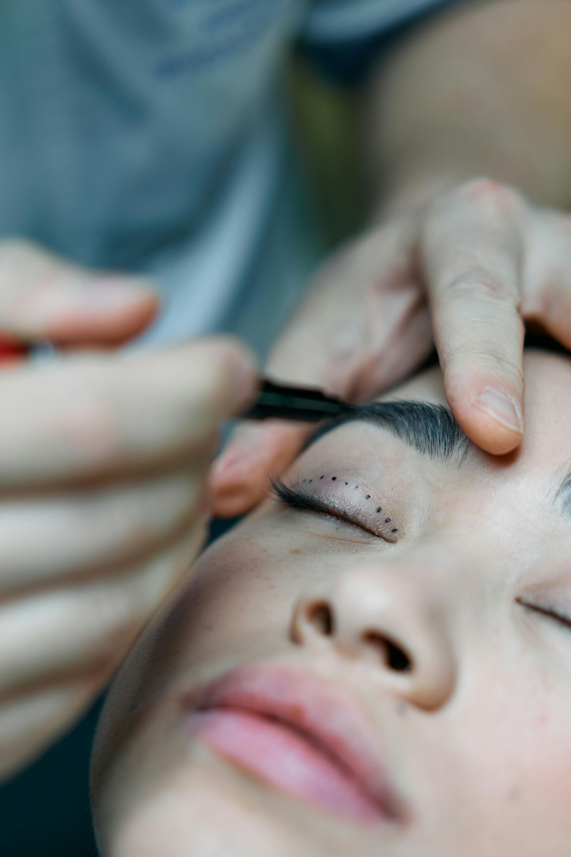 Person having a cosmetic eye procedure, with dots marking the area. Close-up on face, eyes closed.
