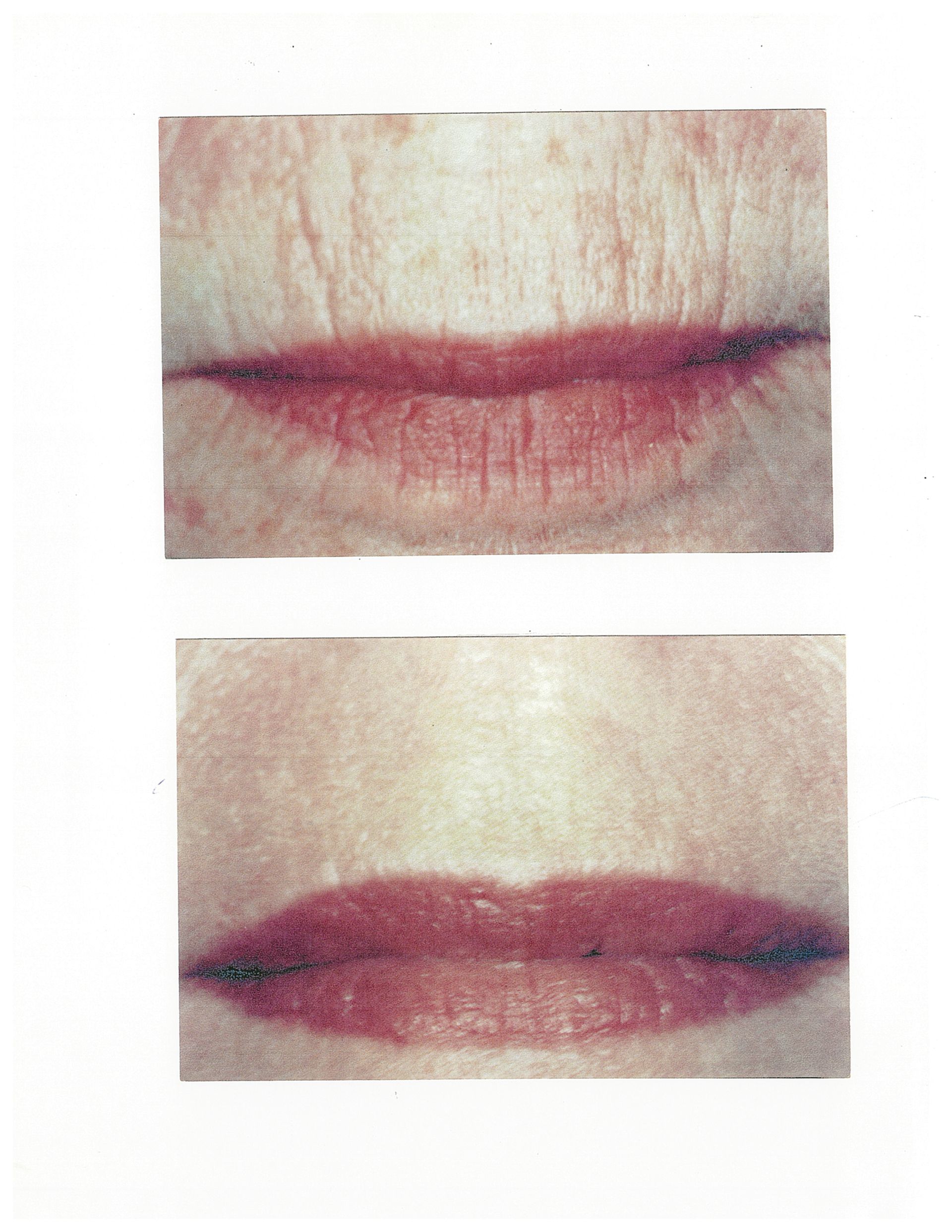 Two close-up shots of red lips, one with wrinkles, the other smoother.