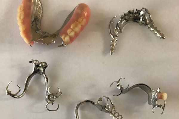 chrome dentures