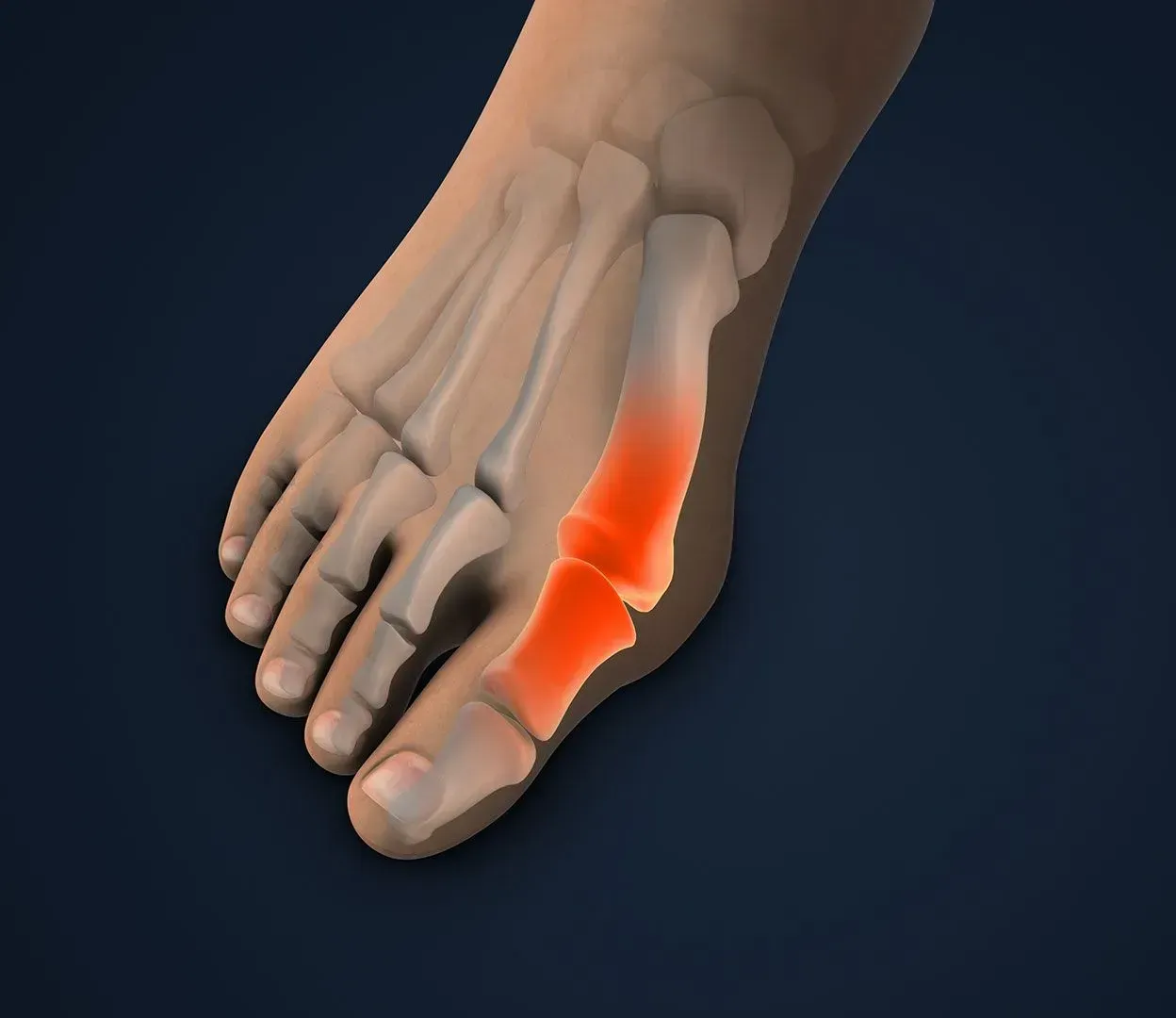 Foot with highlighted red bones, indicating pain in the big toe.