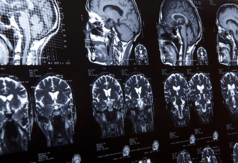a bunch of brain scans hanging up on a hospital wall