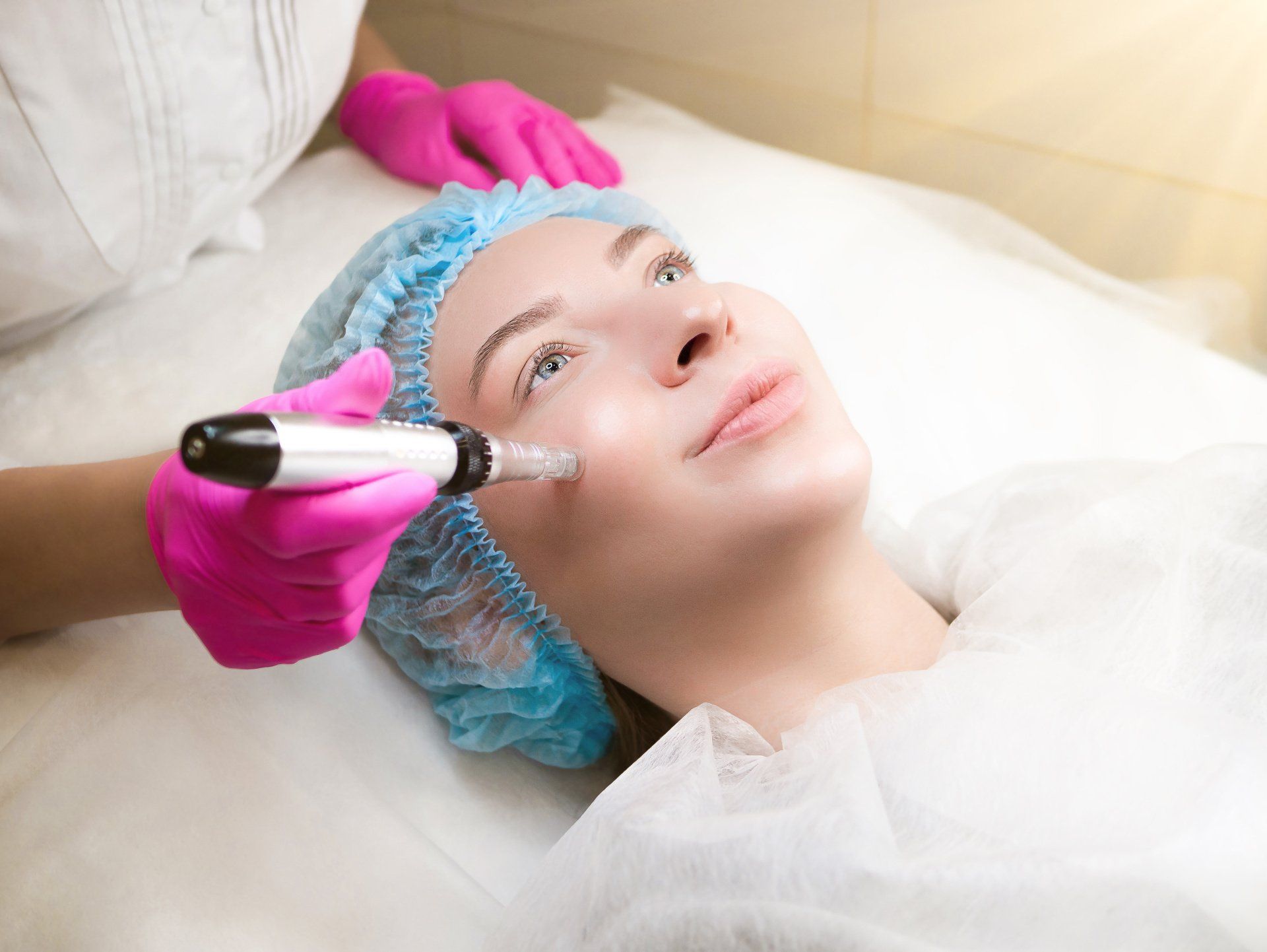 micro-needling beauty services
