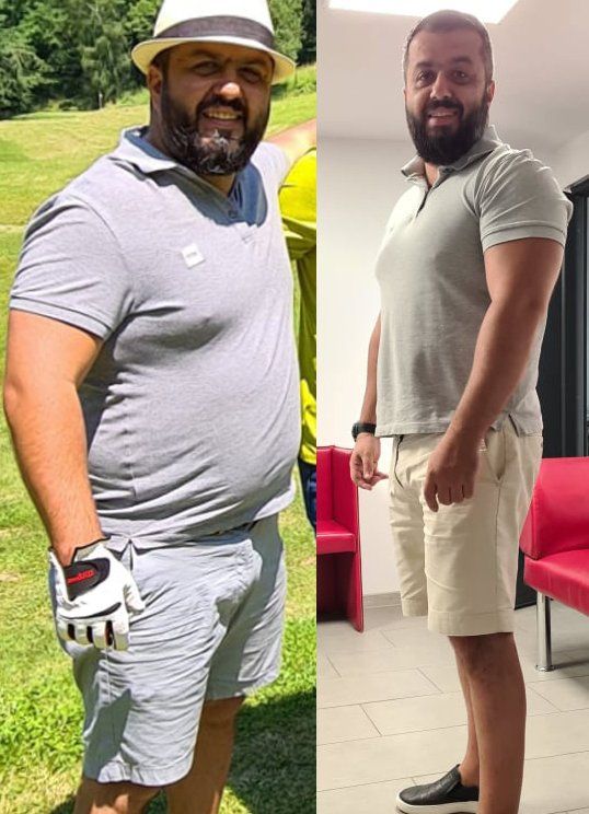 Before and after transformation photo of a man who lost 20kg, showcasing remarkable weight loss progress.