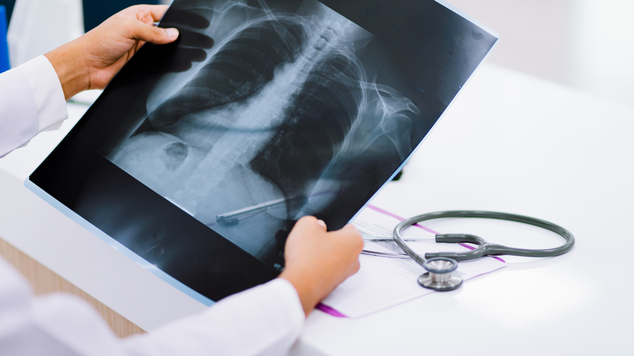 How Can Patients Navigate the Complex Pricing of X-Ray Services?