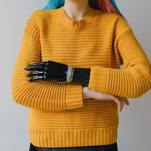 Woman in yellow shirt crossing her arms - one arm is prosthetic