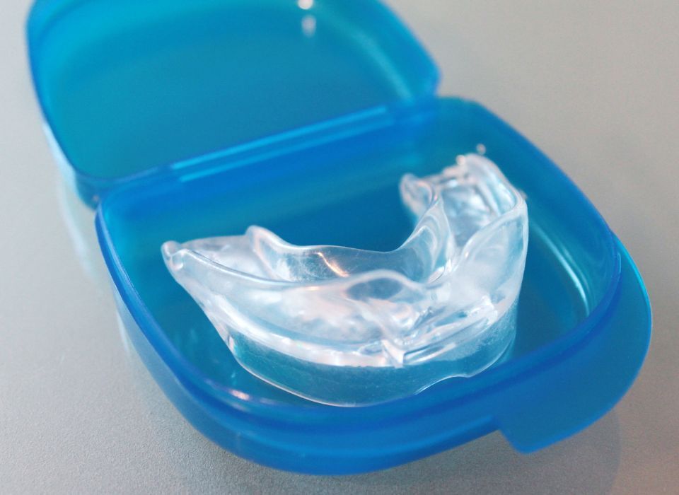 Clear mouthguard in a blue plastic case.