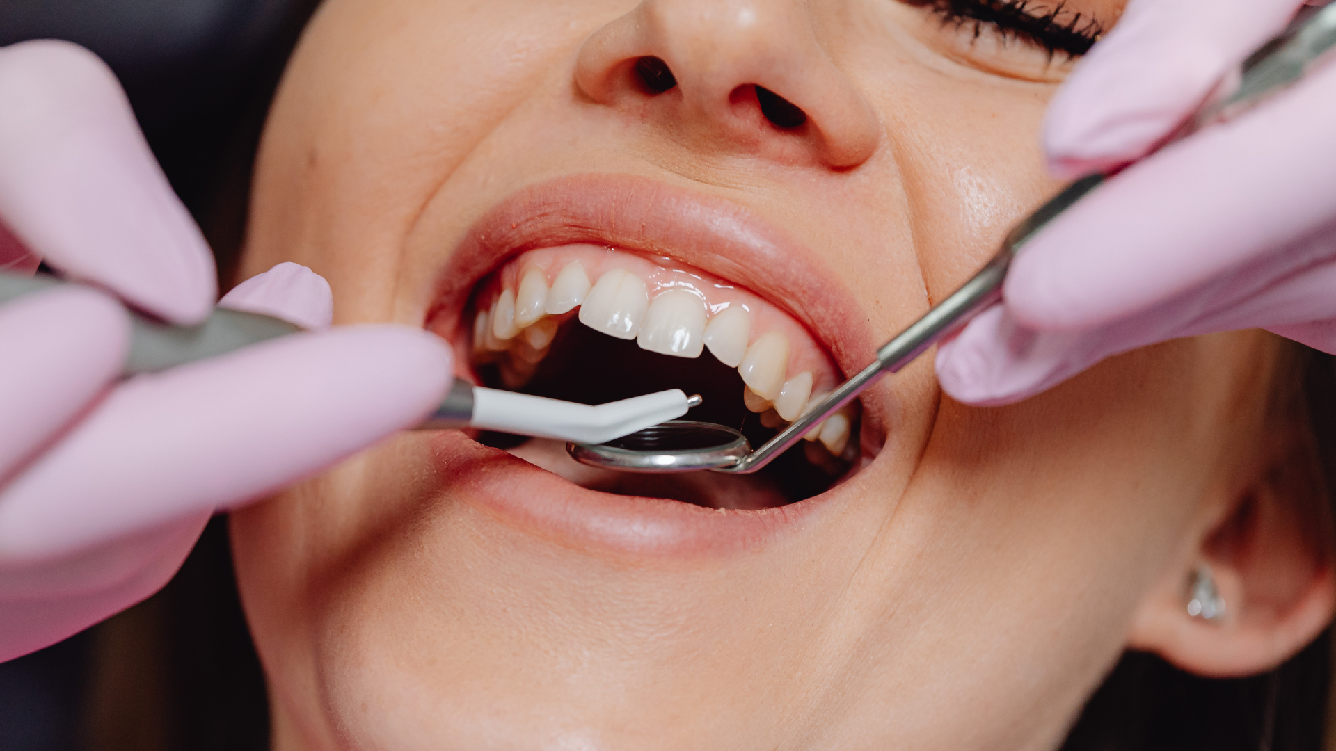 A woman is getting her teeth examined by a dentist.