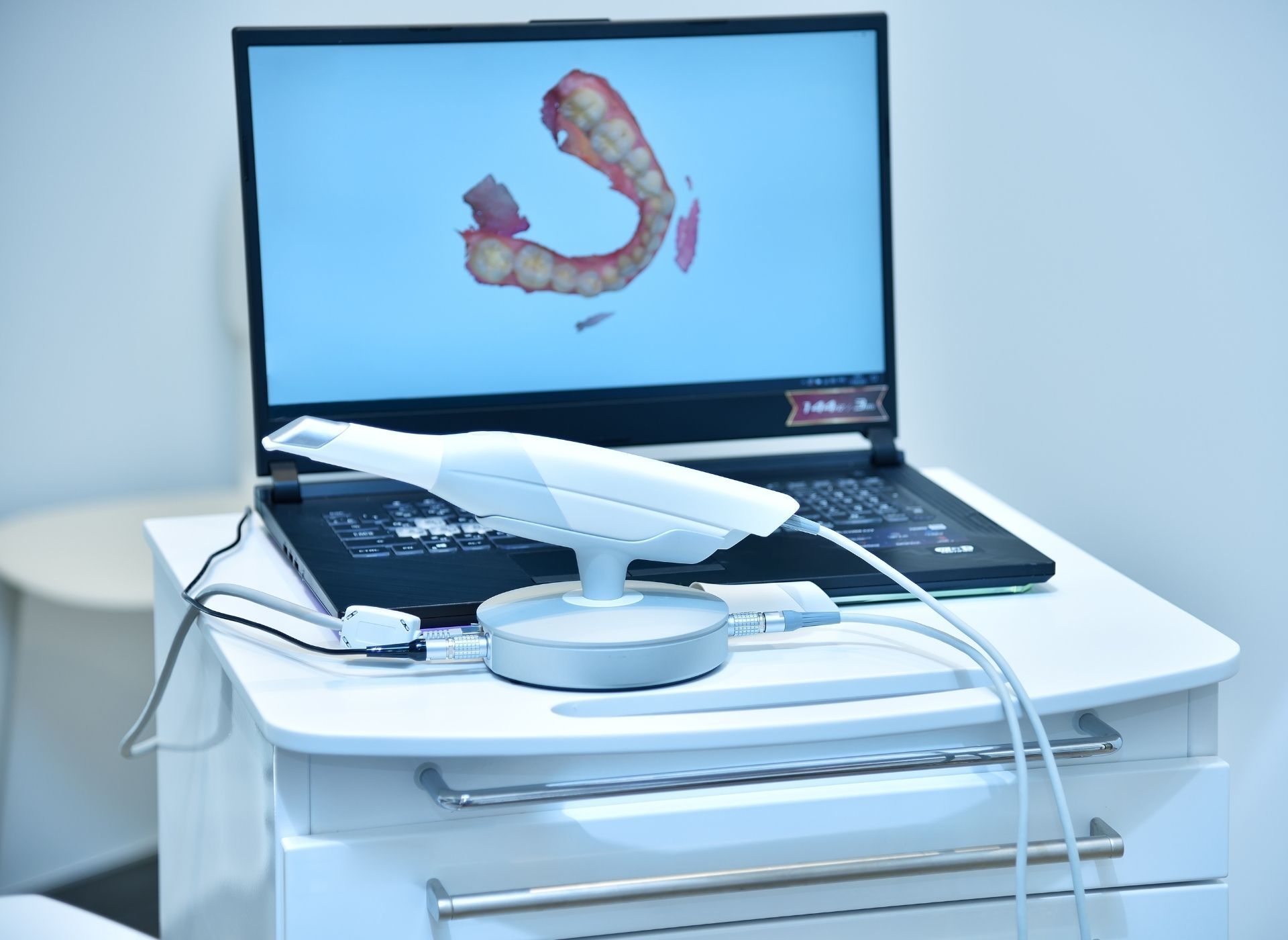 Dental scanner on a white cart with a laptop displaying a 3D scan of teeth.