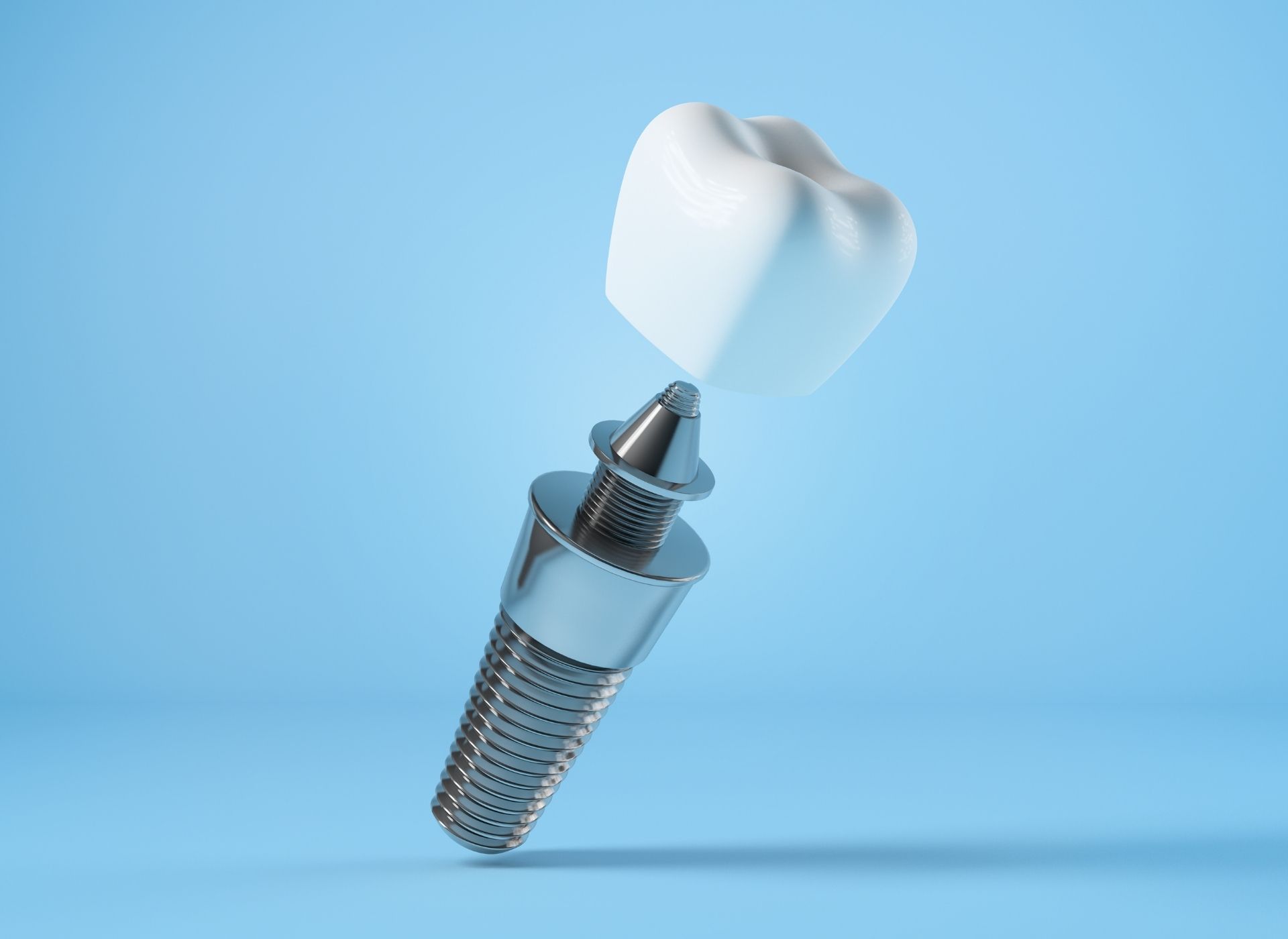 Dental implant with a white crown, against a blue background.