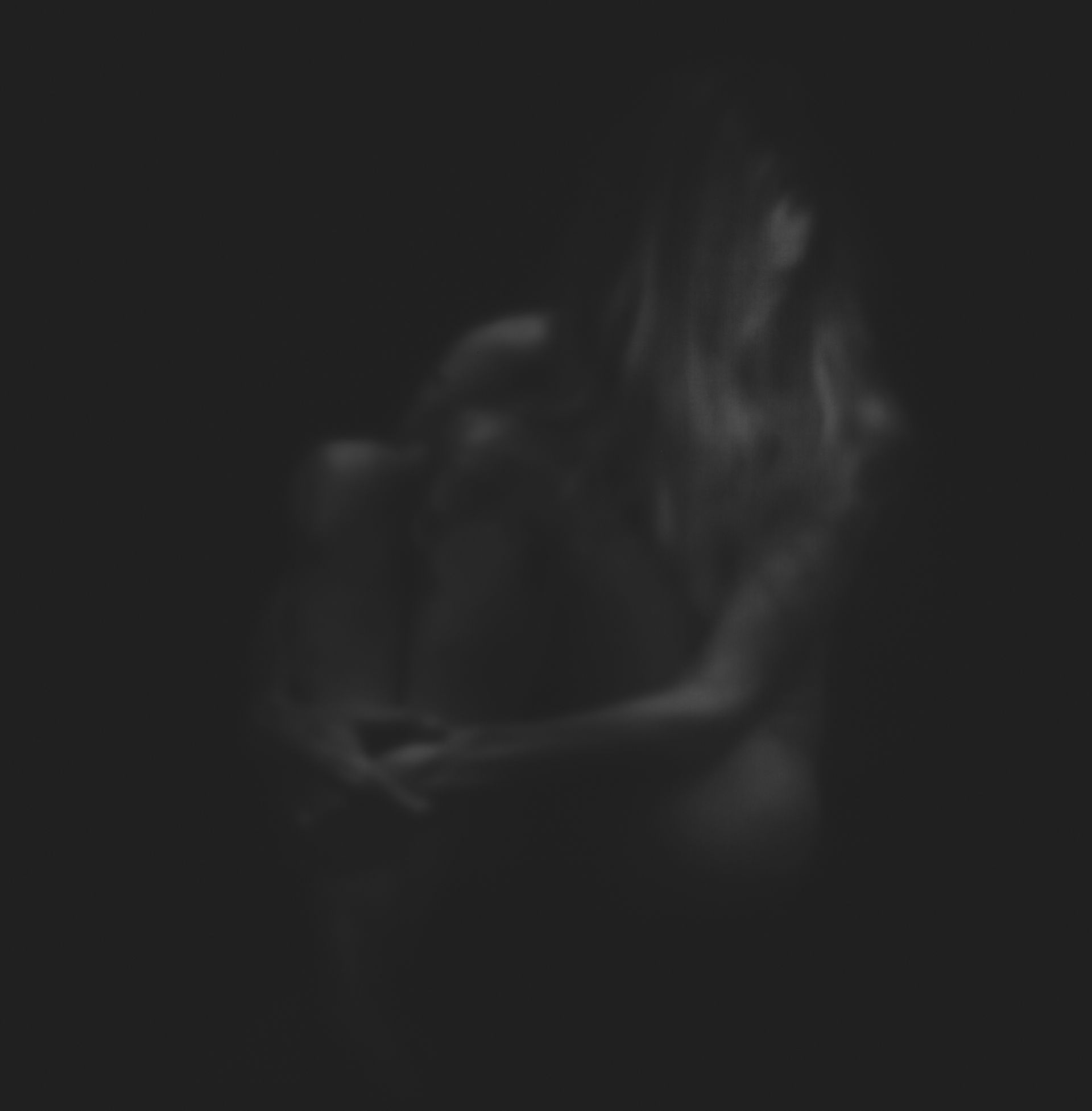 Woman in soft focus, embracing herself, partially visible in a dark setting.