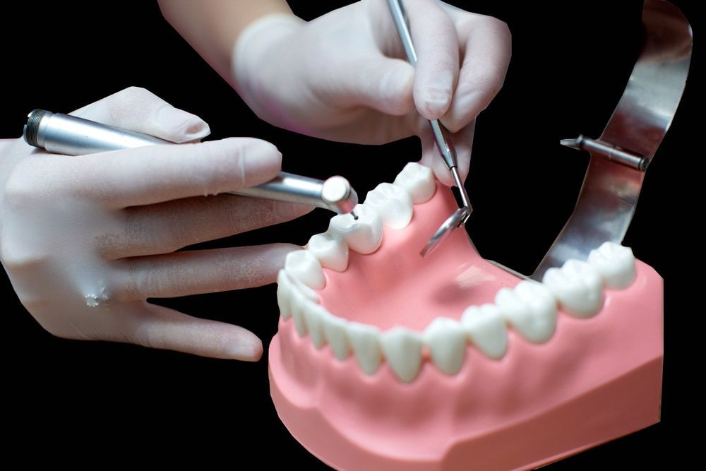 Cleaning a Model of Teeth with A Toothbrush — Bromley's Denture Clinic in Tweed Heads South, NSW