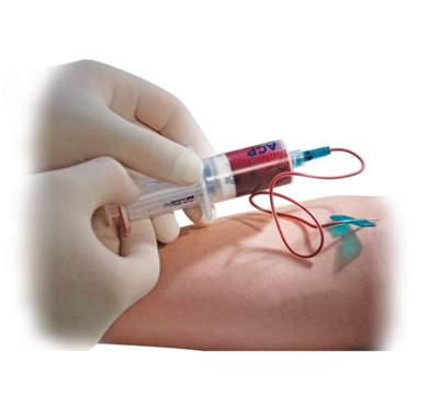 Dr. Matthias Wolf, Orthopäde, Behandlungen, ACP Eigenbluttherapie