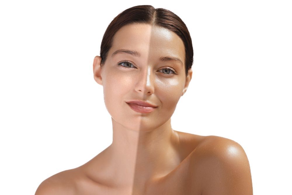 A woman 's face is shown before and after getting a tan.