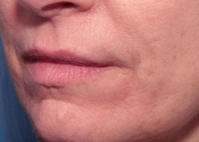 A close up of a woman 's face with wrinkles on her lips.