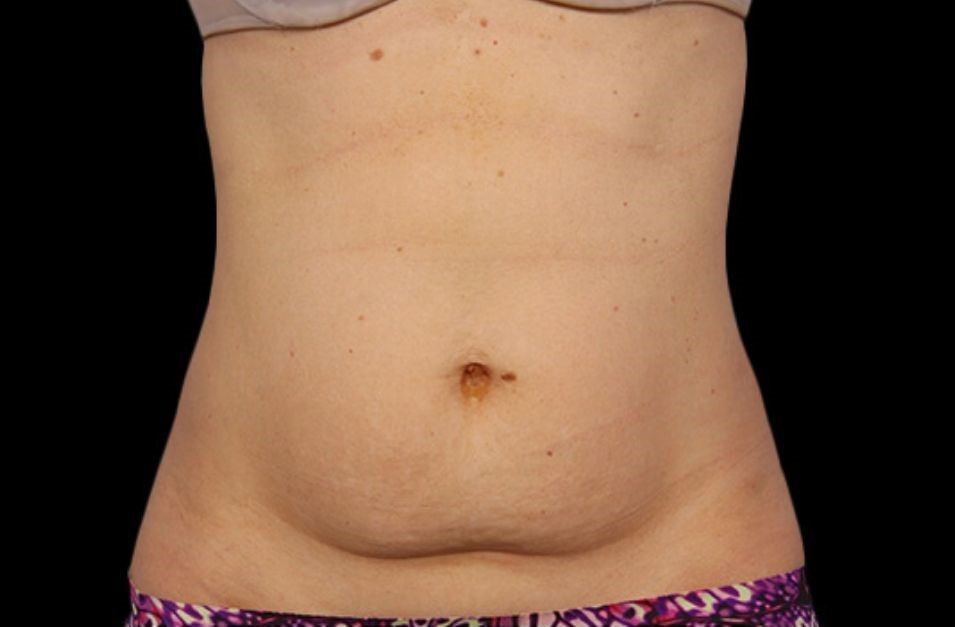 A woman 's stomach is shown with a black background.