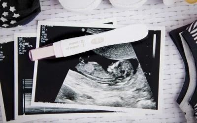 pregnancy test and an ultrasound