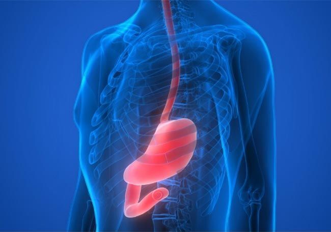Idiopathic gastroparesis poses a unique challenge in the realm of gastroenterology