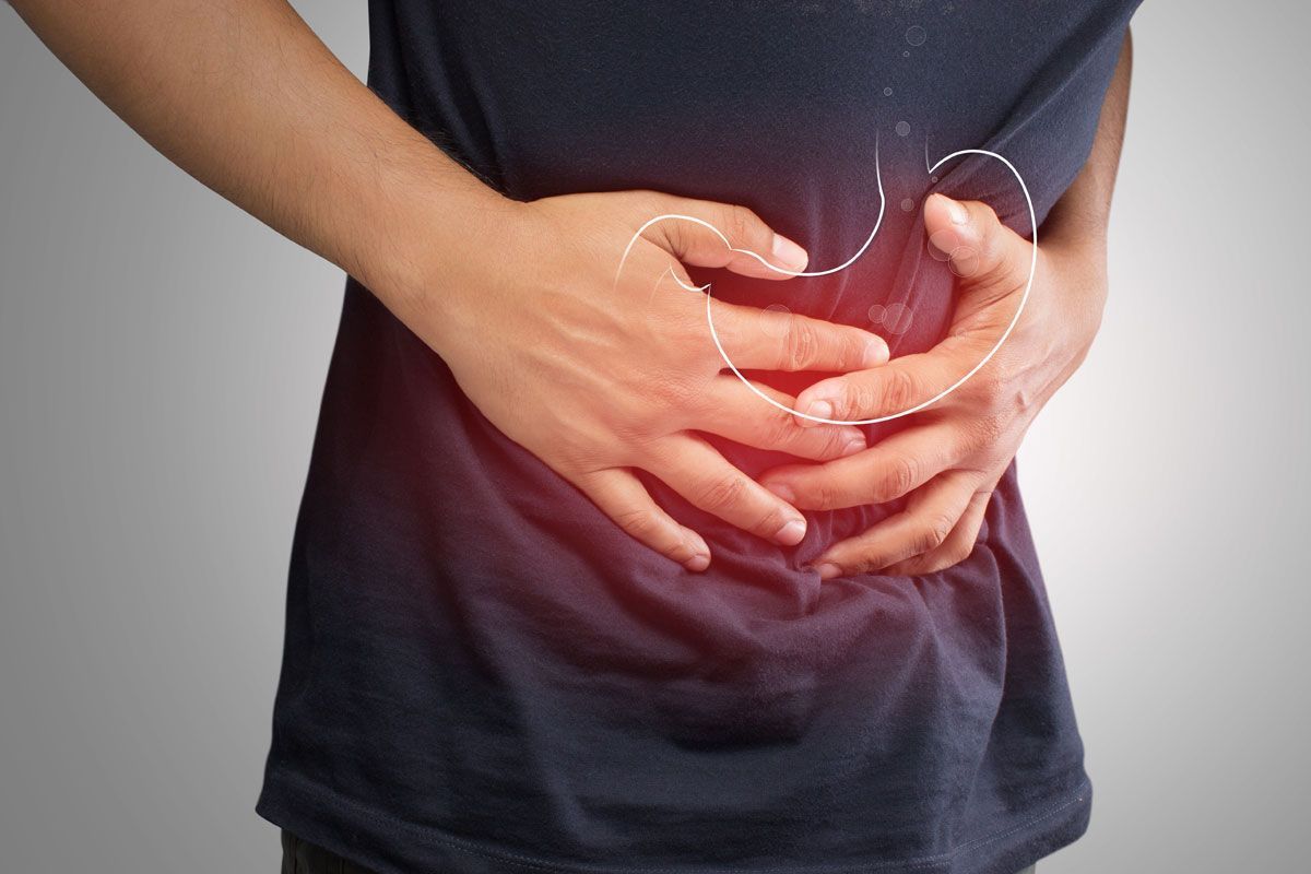 Gastroparesis is a gastrointestinal disorder characterized by delayed emptying of the stomach