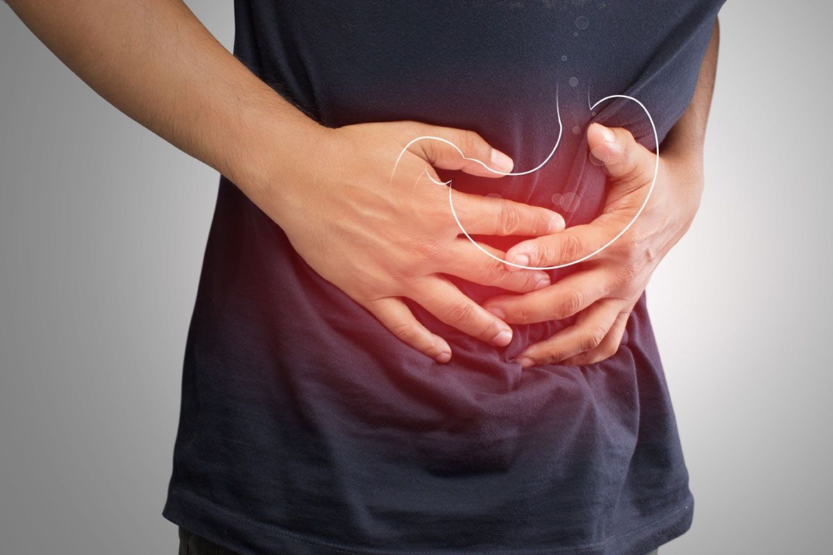 Gastroparesis is a digestive disorder characterized by delayed emptying of the stomach.