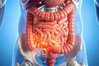 Ulcerative colitis is a chronic inflammatory bowel disease that can significantly impact a person's 