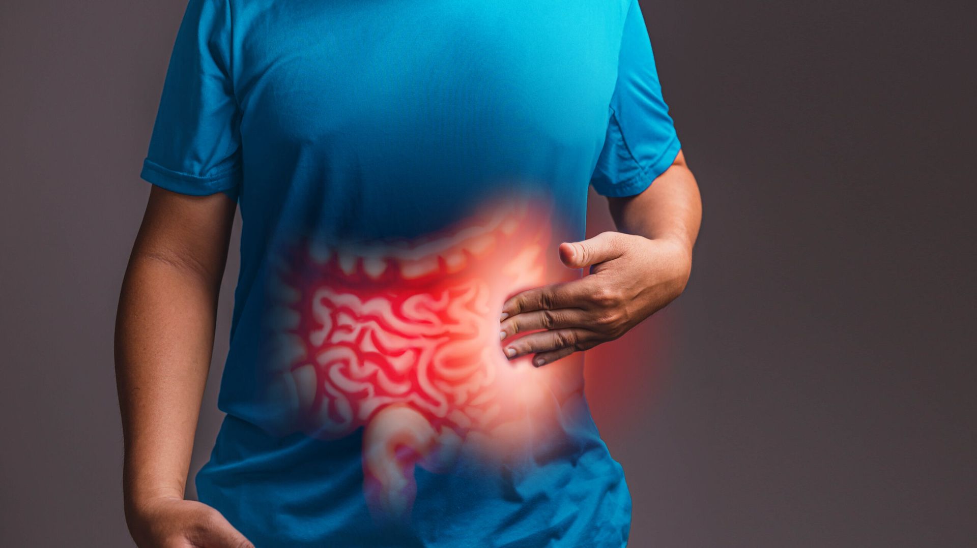 Ulcerative colitis is a chronic inflammatory bowel disease that can significantly impact