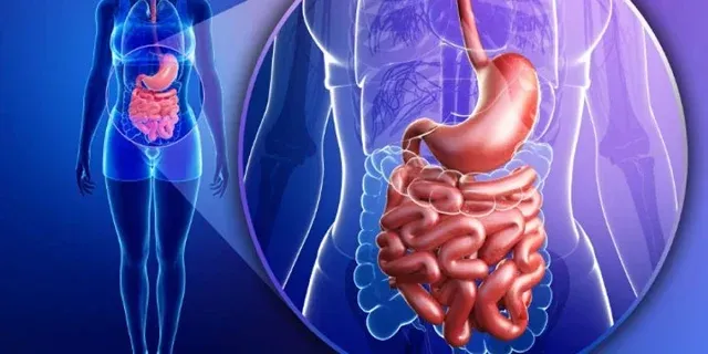 Gastroparesis is a gastrointestinal disorder 
