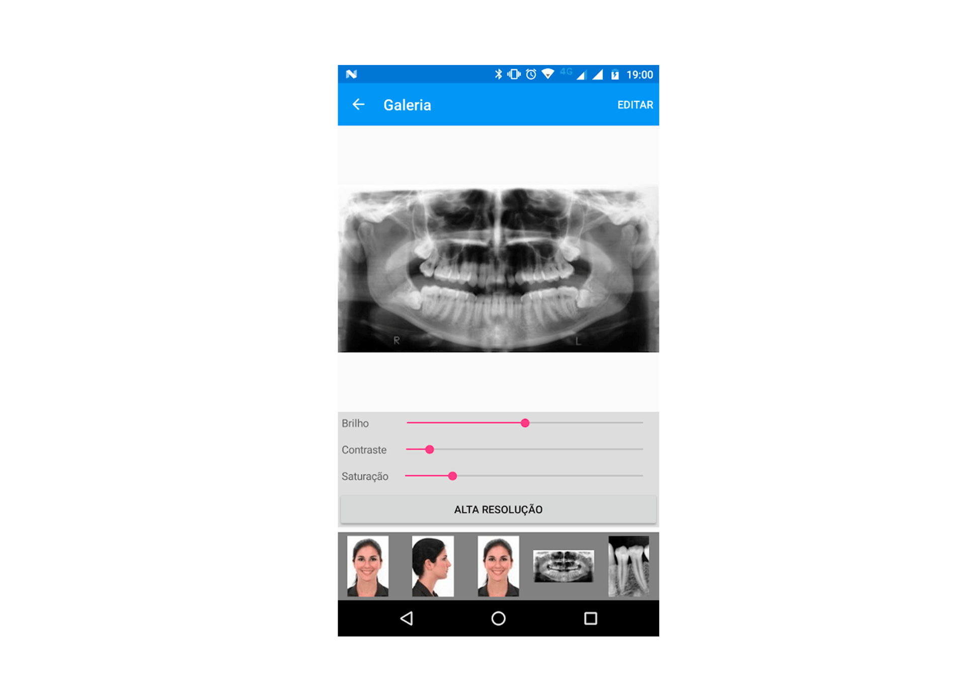 Aplicativo móvel com raio-X odontológico, controles de brilho, contraste e cor, além de pré-visualizações de imagens de pacientes.
