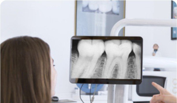 Mulher olhando para uma tela de raio X odontológico no consultório de um dentista.