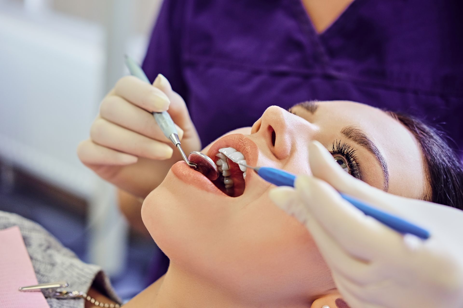 composite restorations in Monroe