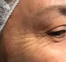 A close up of a woman 's face with wrinkles and a hat on.