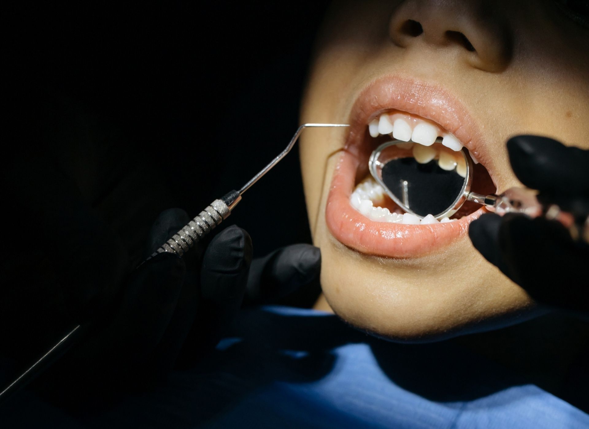 Dentist examining patient's mouth with a mirror and probe. Black gloves, bright lights.