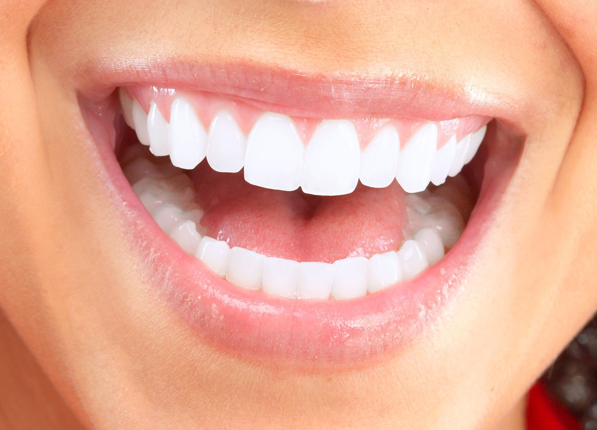 Smiling mouth, showing bright white teeth.