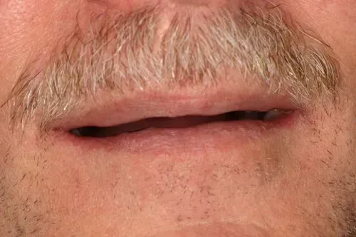 Close-up of a person's mouth, with a mustache and thin lips slightly parted, showing a glimpse of teeth.