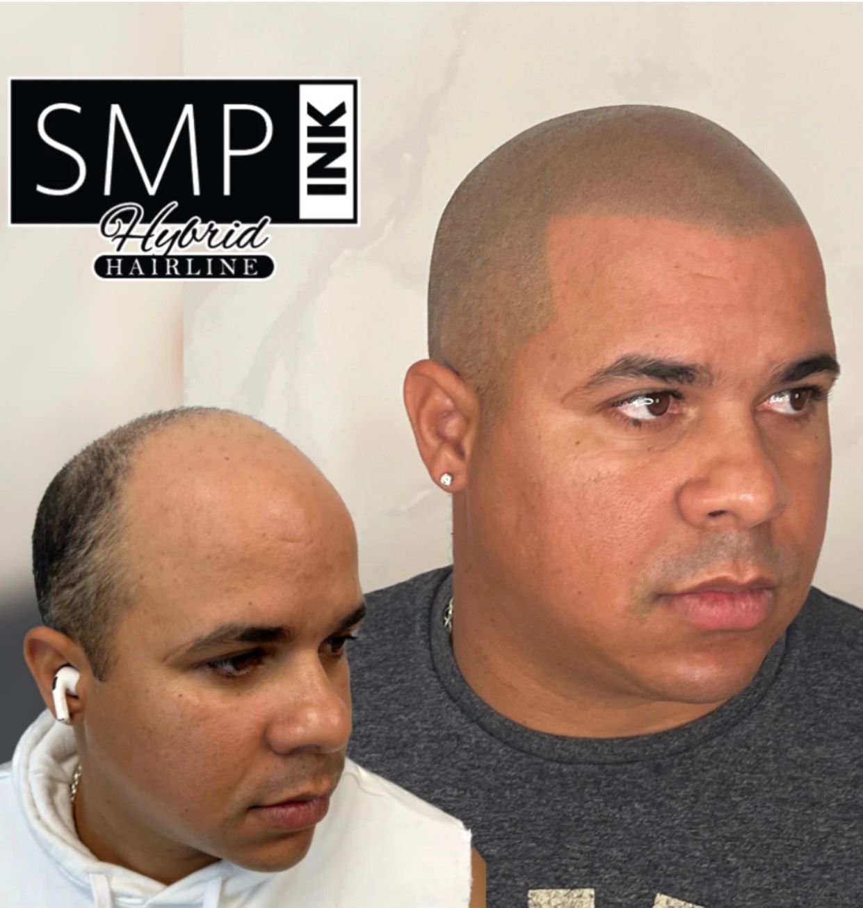 SMP INKED Birmingham Alabama showing before and after photo of male using a buzz cut look after SMP or Hair tattoo