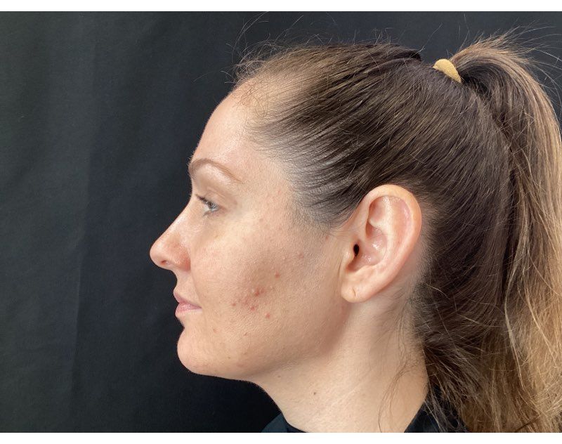 A close up of a woman 's face with a ponytail.