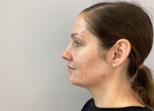 A close up of a woman 's face with a ponytail and earrings.