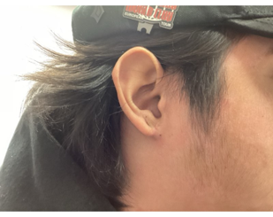 Close-up of a person's right ear and side profile, showing dark hair worn under a black cap with a small logo.