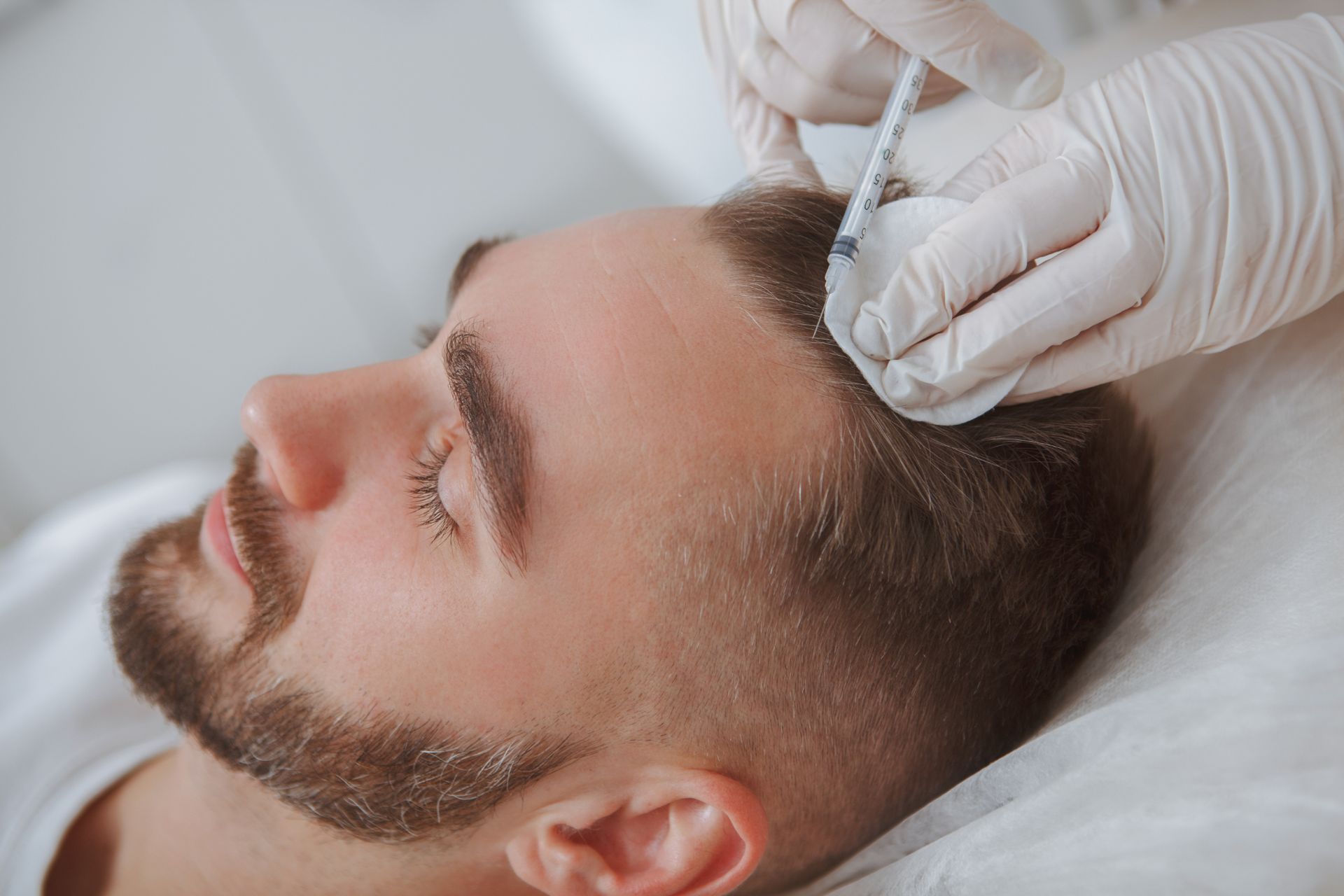 A man with a beard is getting a hair transplant.