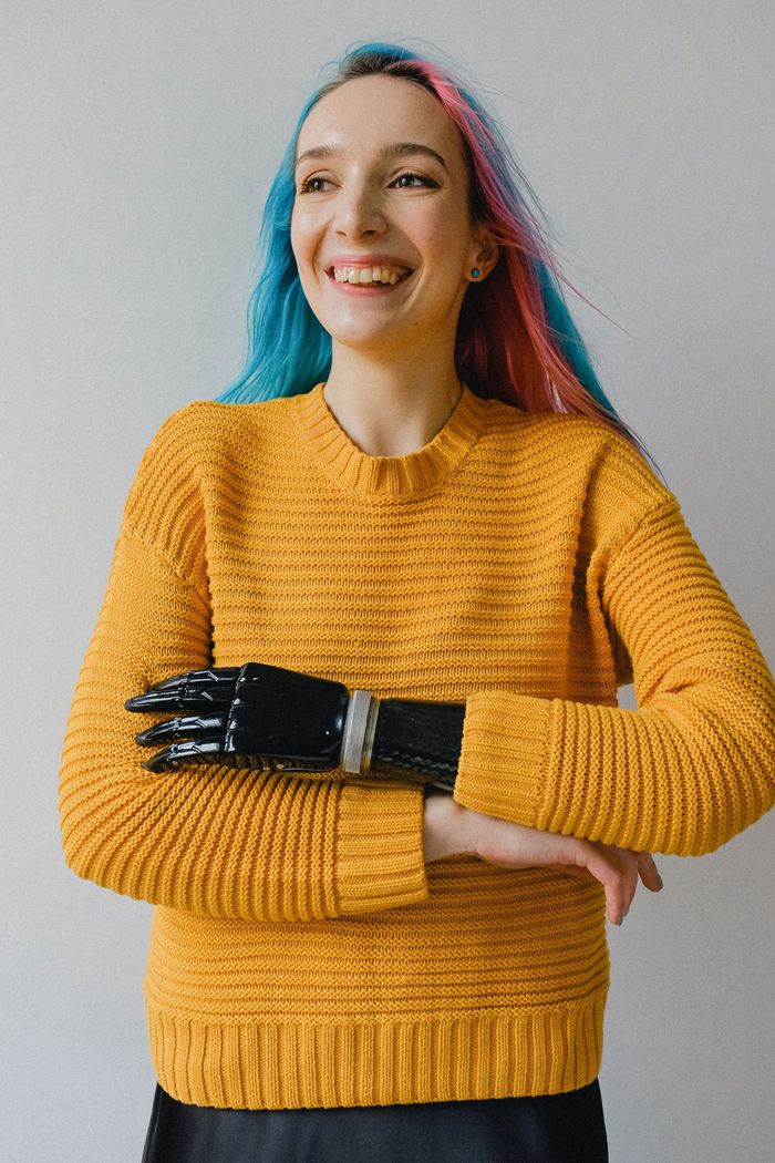A young woman in chunky knitwear with a prosthetic arm crosses her arms as she laughs.