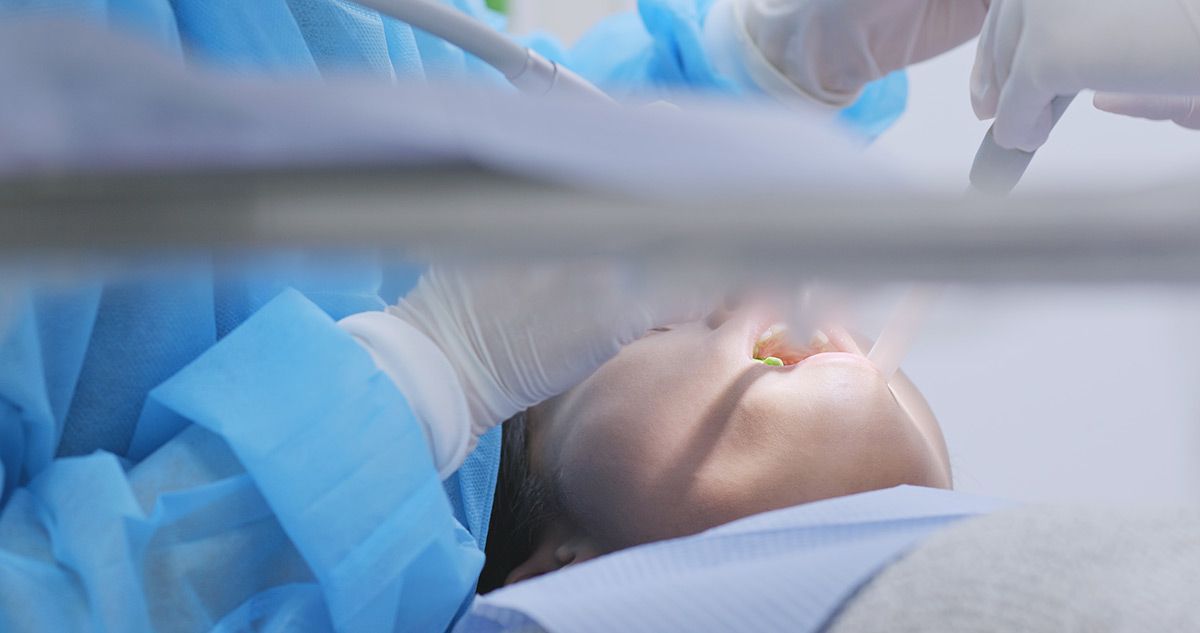 wisdom teeth compacted model.