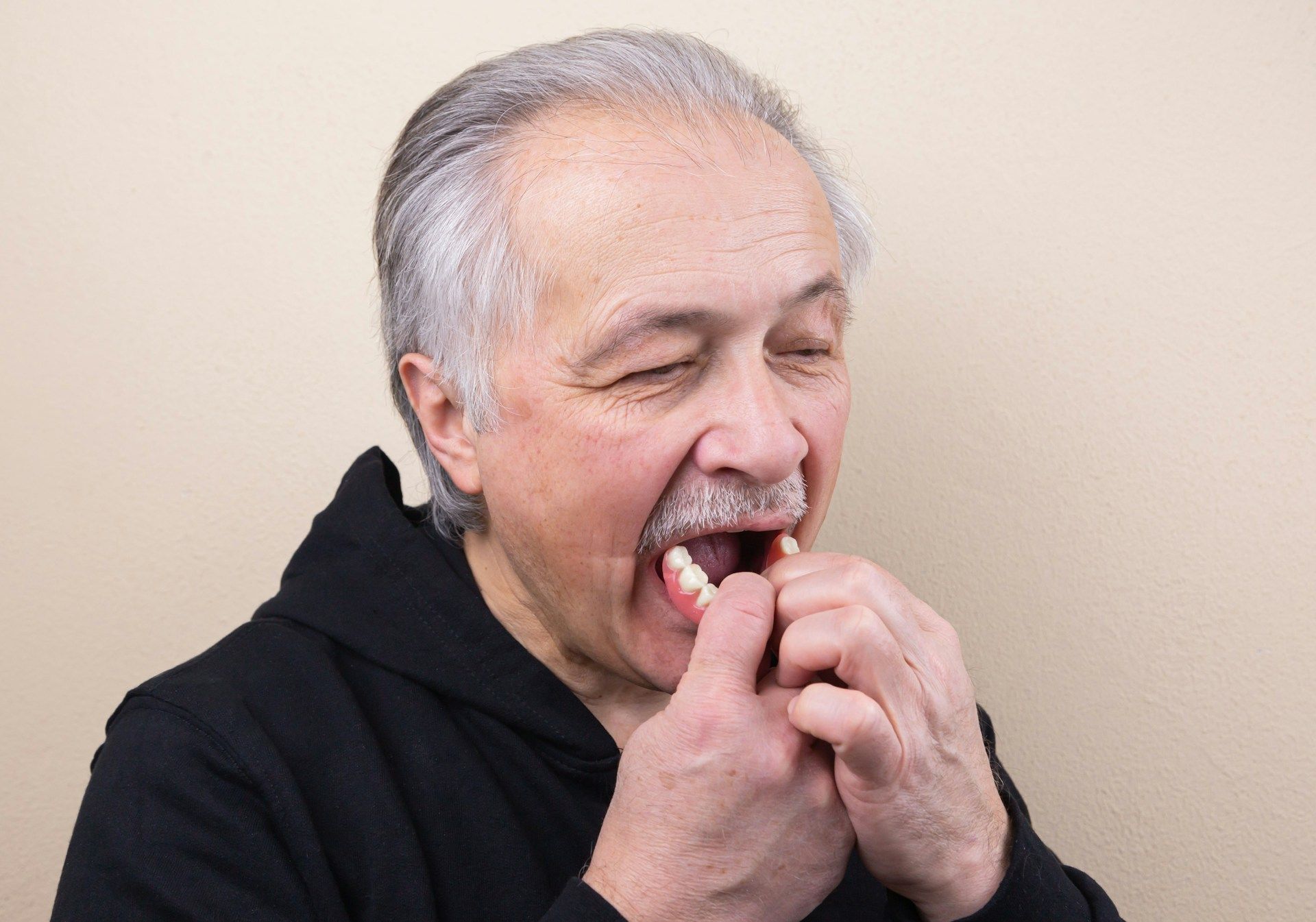 An elderly man is holding his denture in his hands.