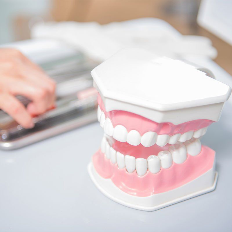 Dentist Hand Holding Teeth Model — Bunbury WA — FADC Dental Group