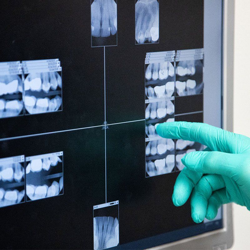 A Dentist Wearing Surgical Gloves Pointing to An X-Ray of Teeth — Bunbury WA — FADC Dental Group