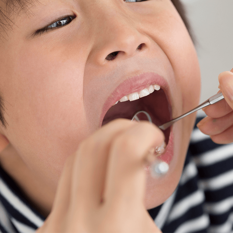 Dental Treatment — Bunbury WA — FADC Dental Group