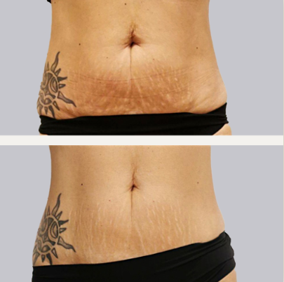 a woman is getting her eyebrows done by a makeup artist