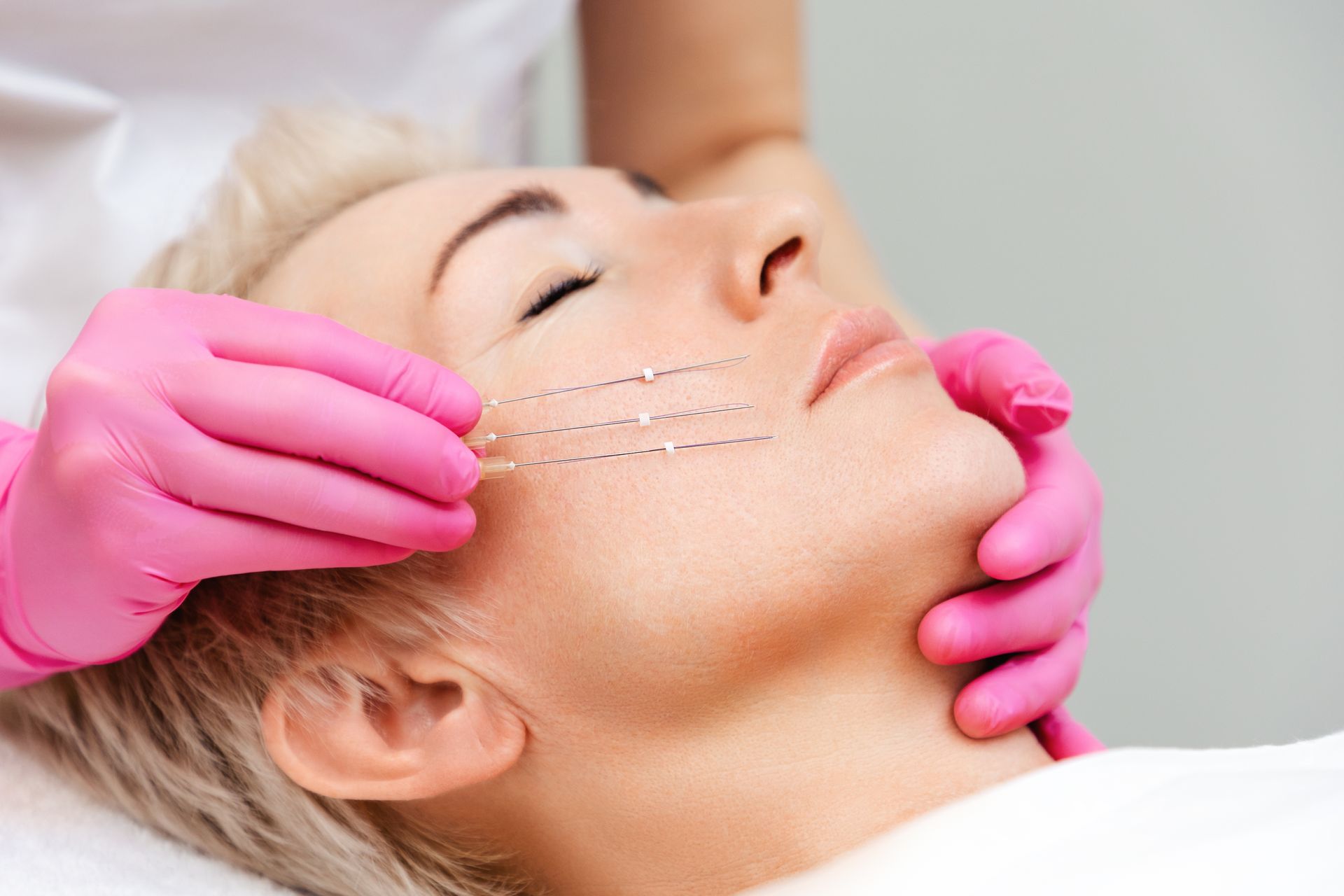 a woman in pink gloves is giving a thread lift facial treatment