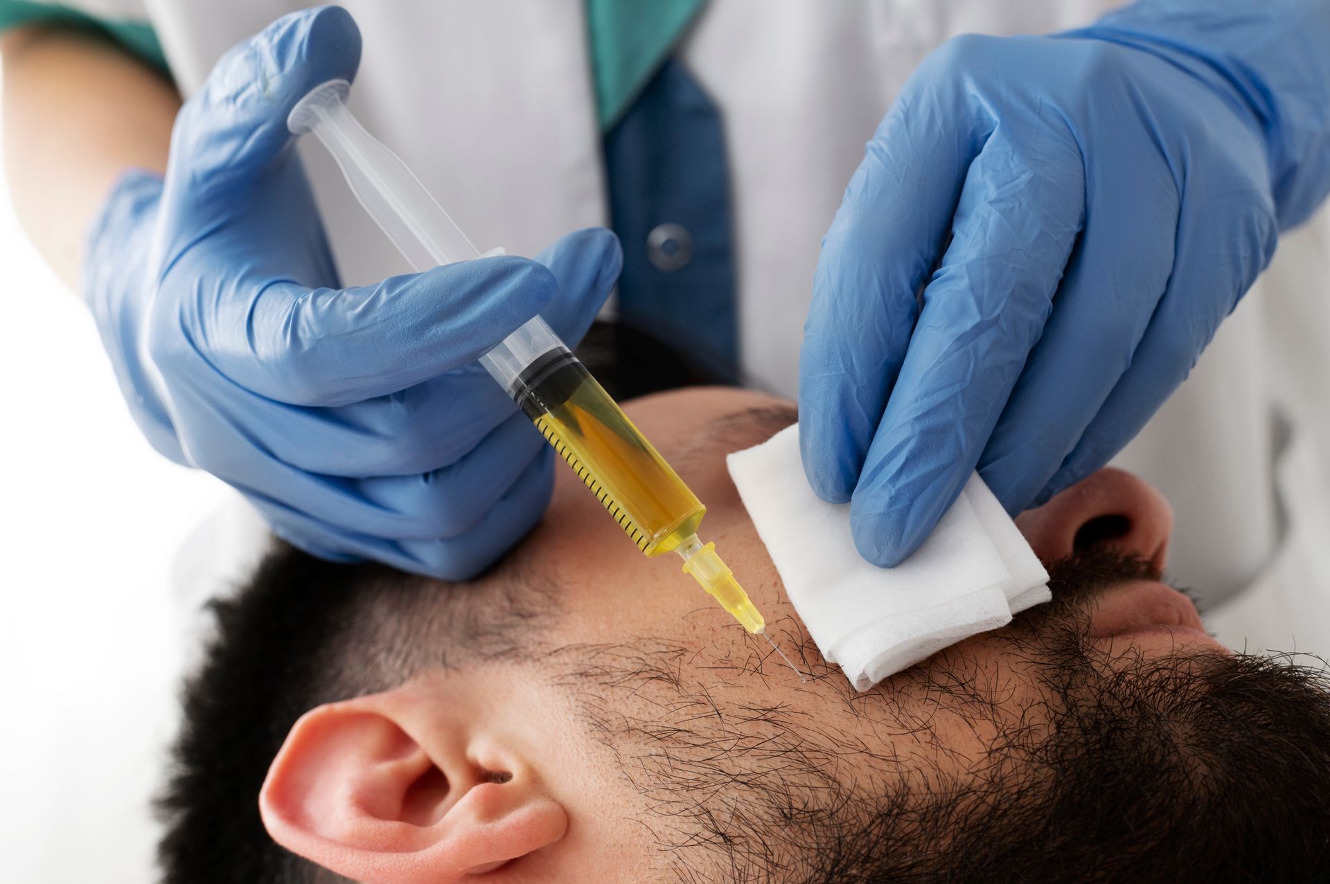 a man is getting  a prp injection on his face by a doctor