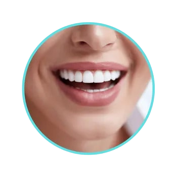 Image depicting women laughing after receiving teeth whitening services