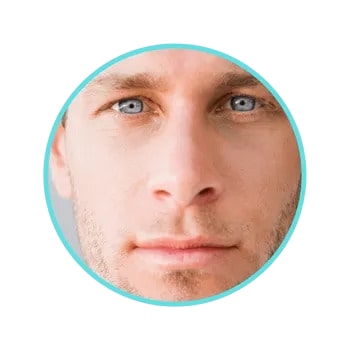 Under Eye Dark Circle Camouflage results in Pittsburgh by Effortless Beauty PGH.